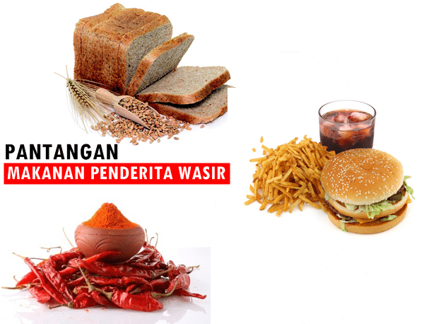 5 Pantangan  Makanan  bagi  Penderita Wasir atau Ambeien