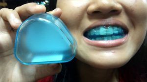 apakah teeth trainer bisa merapikan gigi