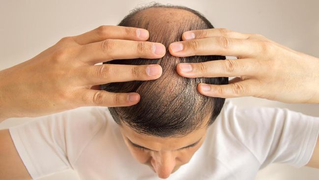 shampo yang bagus untuk rambut rontok